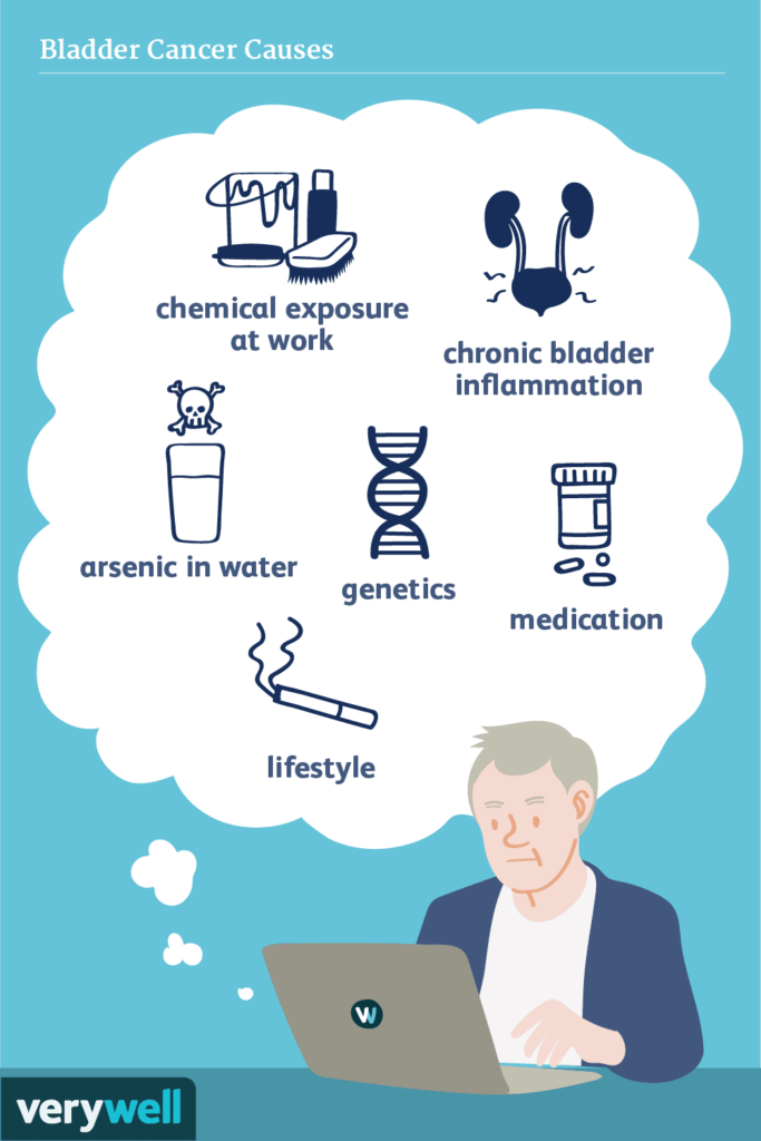 Risk Factors And Precautions For Bladder Cancer