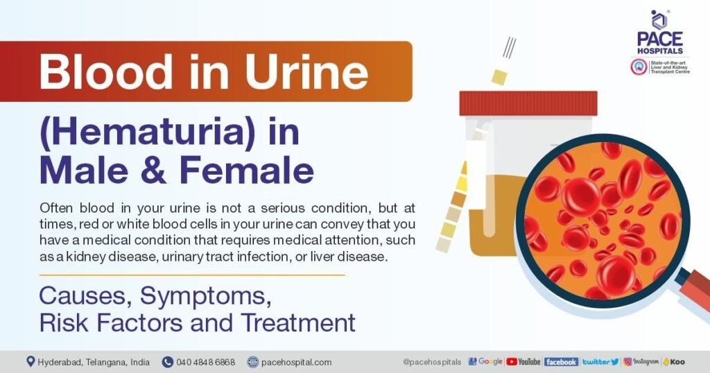 Risk Factors And Precautions For Blood In Urine