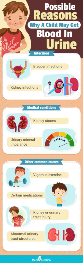 Risk Factors And Precautions For Blood In Urine