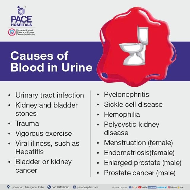 Risk Factors And Precautions For Blood In Urine