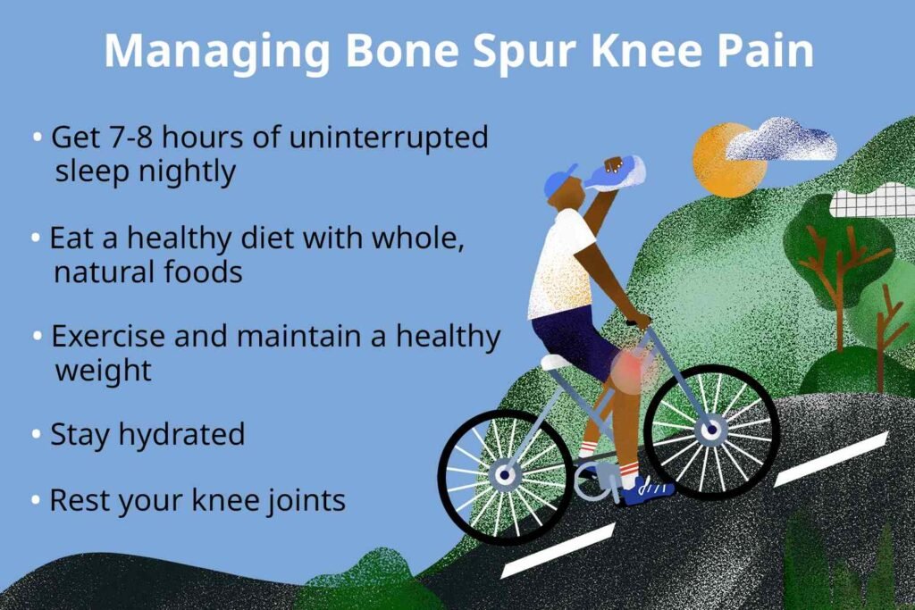 Risk Factors And Precautions For Bone Spurs