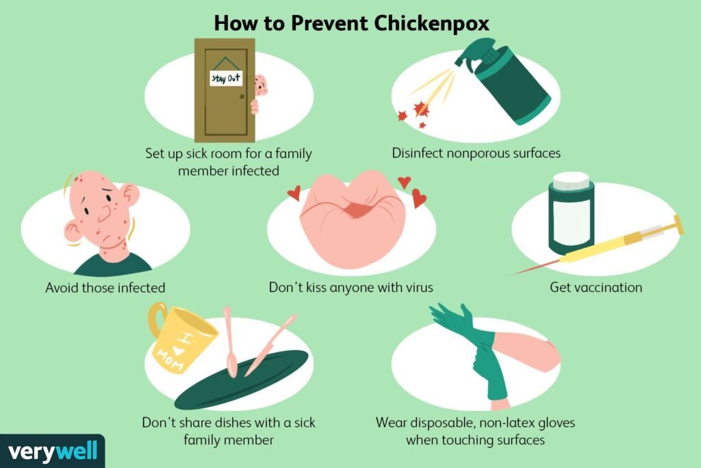 Risk Factors And Precautions For Chicken Pox