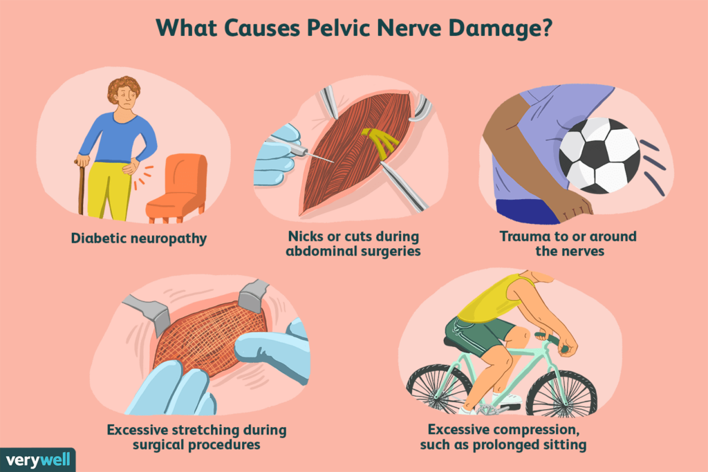 Risk Factors And Precautions For Chronic Pelvic Pain