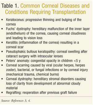 Risk Factors And Precautions For Cornea Transplant