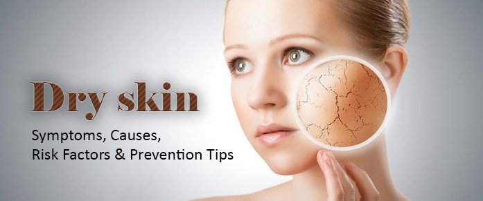Risk Factors And Precautions For Dry Skin
