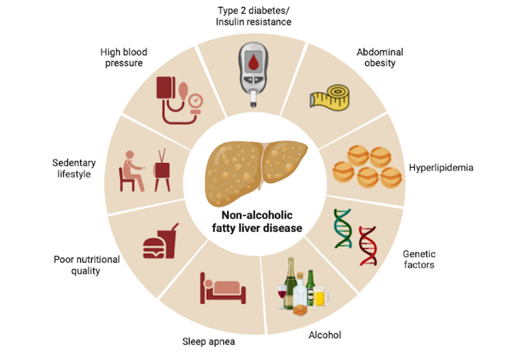 Risk Factors And Precautions For Fatty Liver Disease