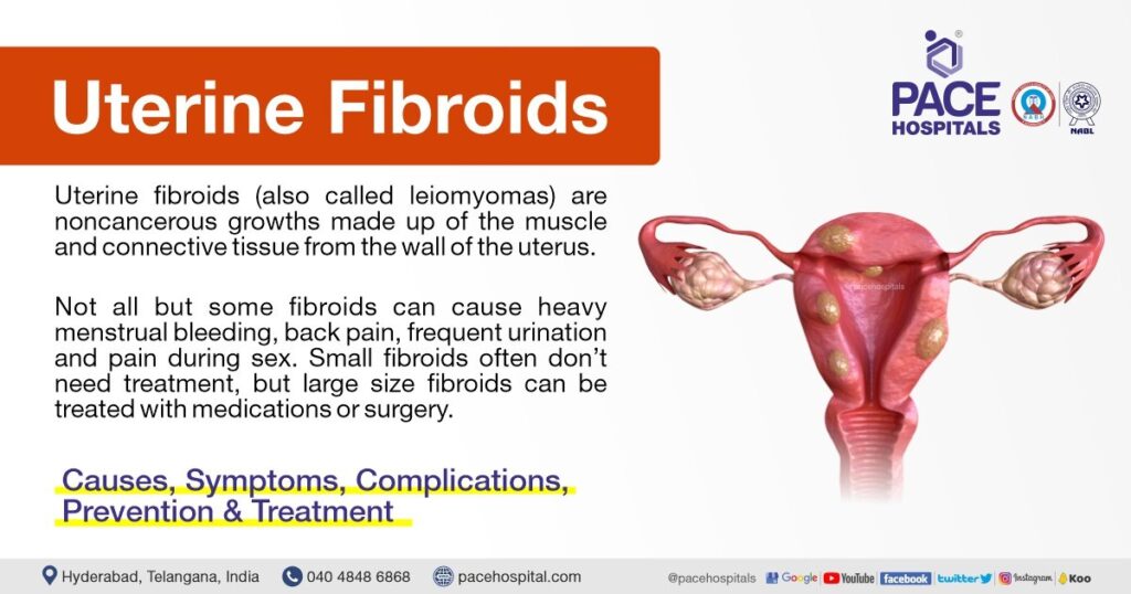 Risk Factors And Precautions For Fibroids