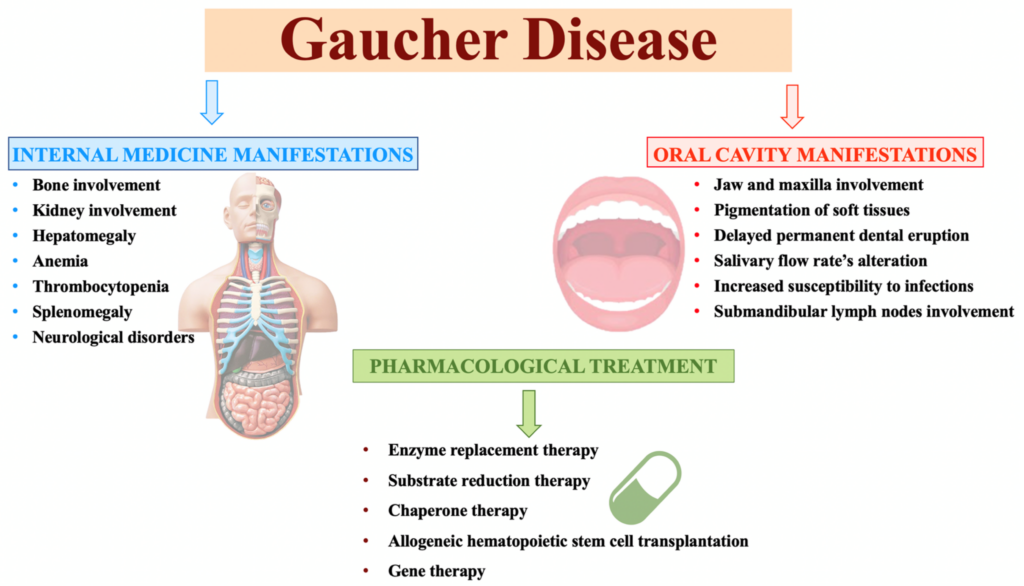 Risk Factors And Precautions For Gaucher Disease