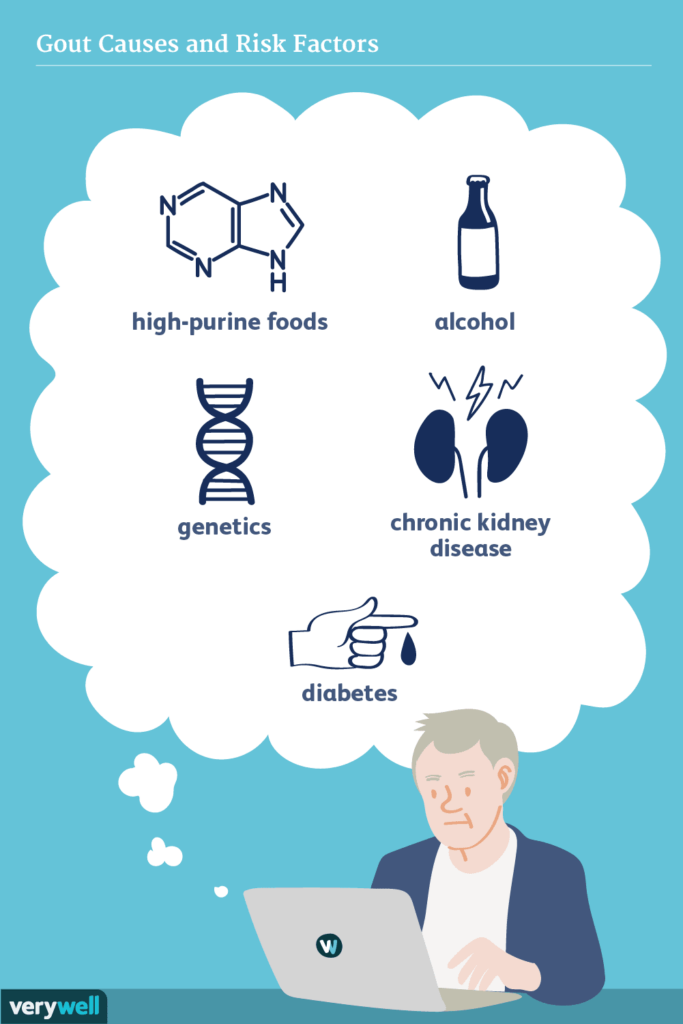 Risk Factors And Precautions For Gout