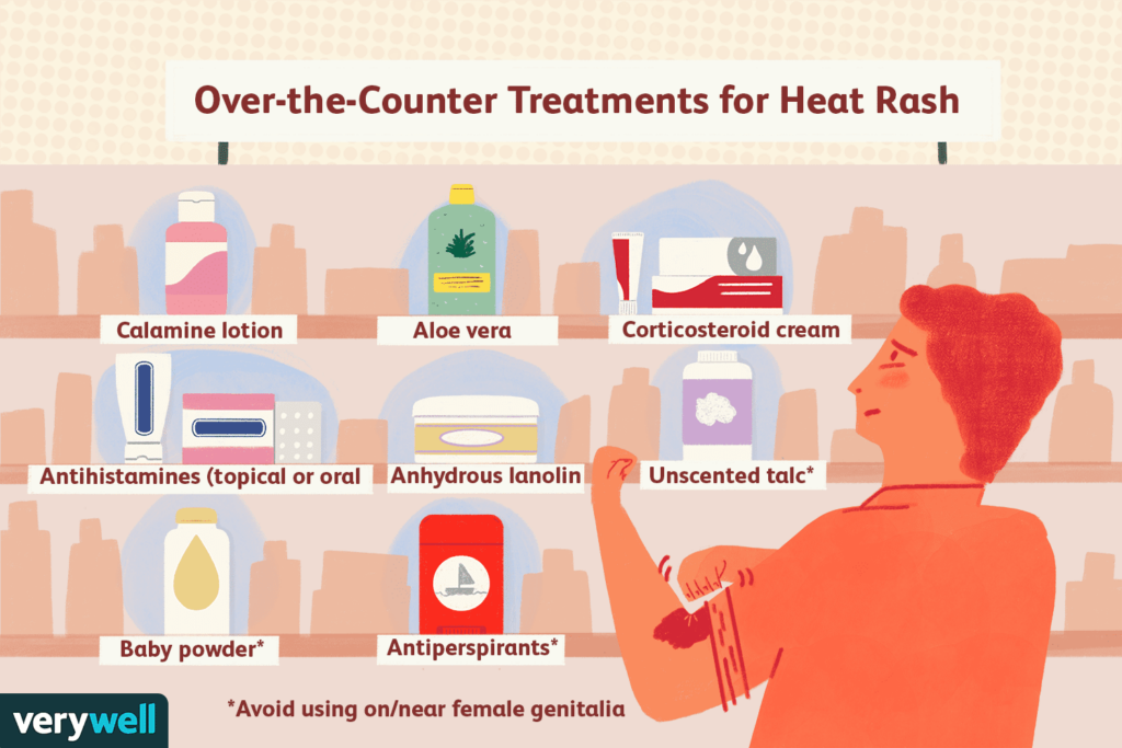 Risk Factors And Precautions For Heat Rash