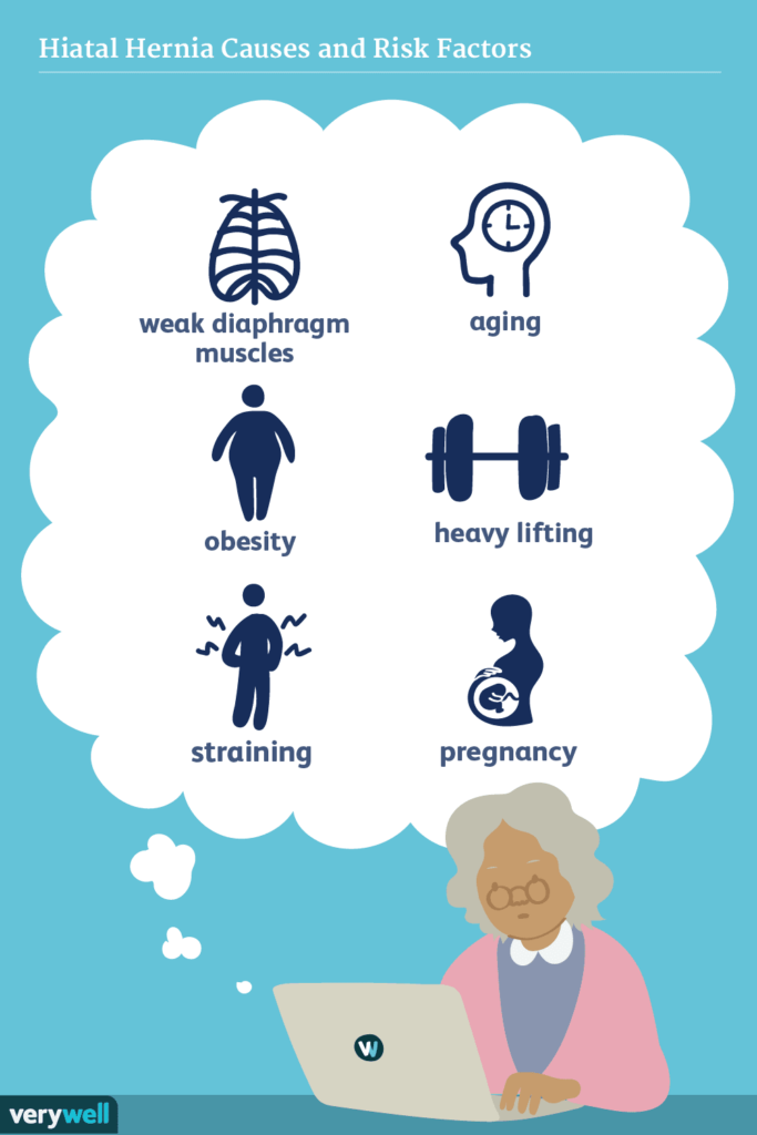 Risk Factors And Precautions For Hiatal Hernia Diet