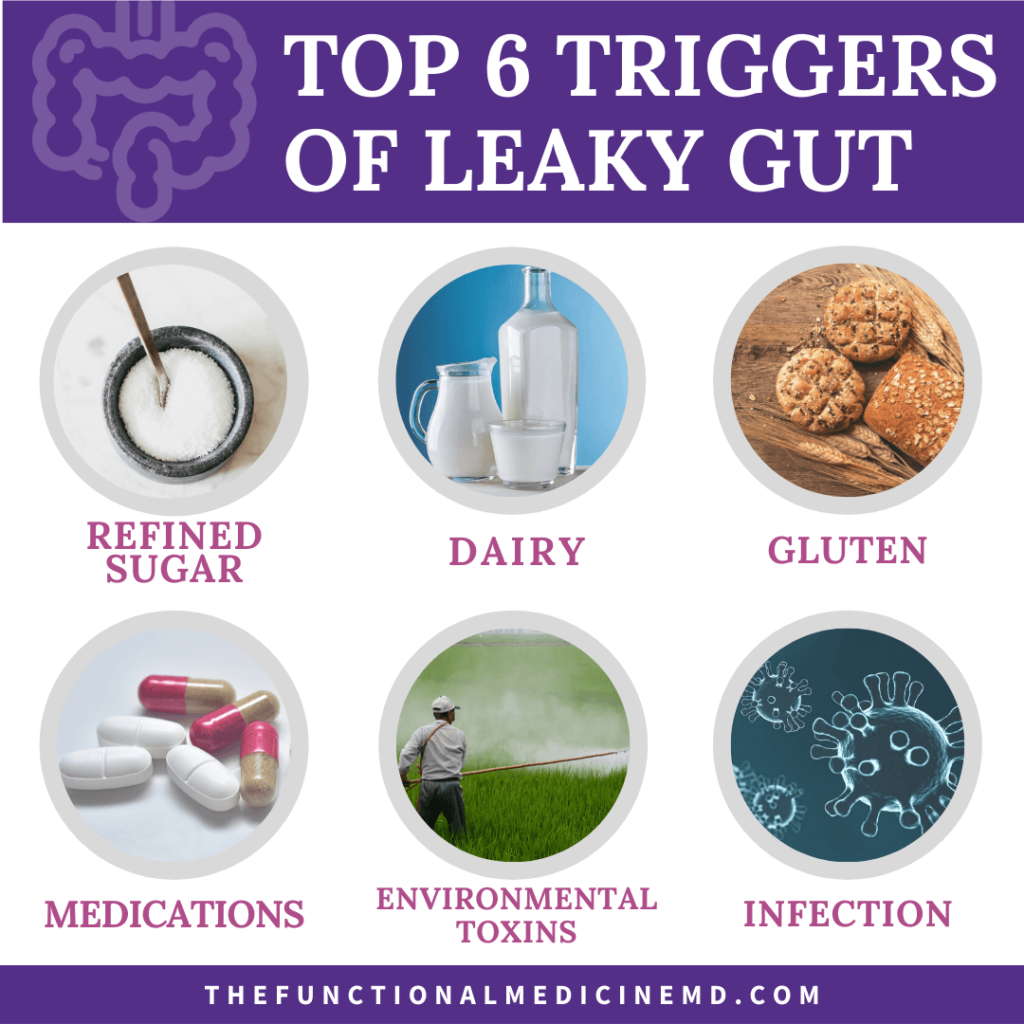 Risk Factors And Precautions For Leaky Gut Syndrome