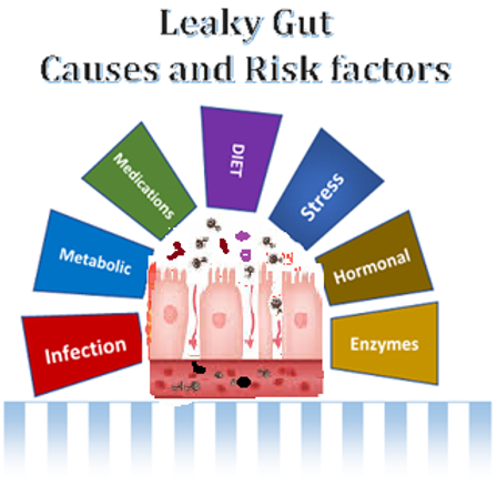 Risk Factors And Precautions For Leaky Gut Syndrome