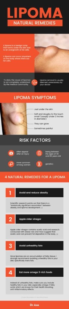 Risk Factors And Precautions For Lipoma