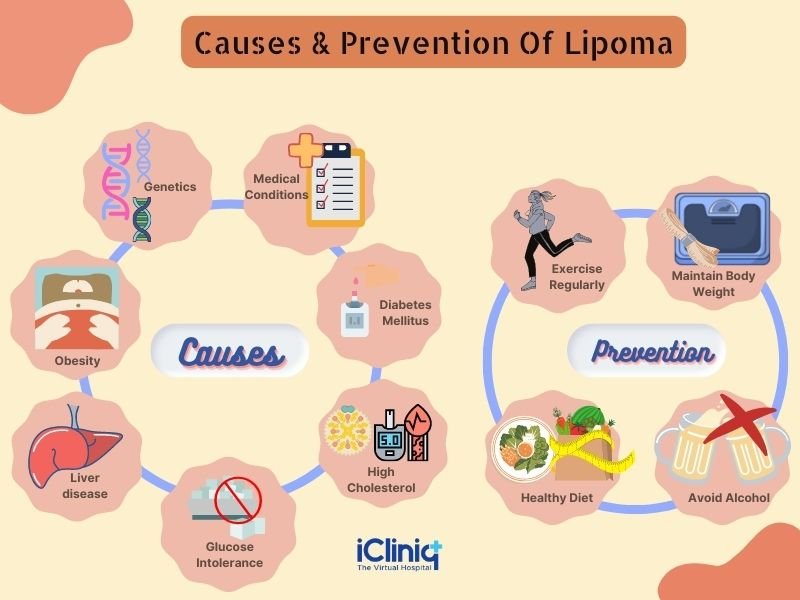 Risk Factors And Precautions For Lipoma