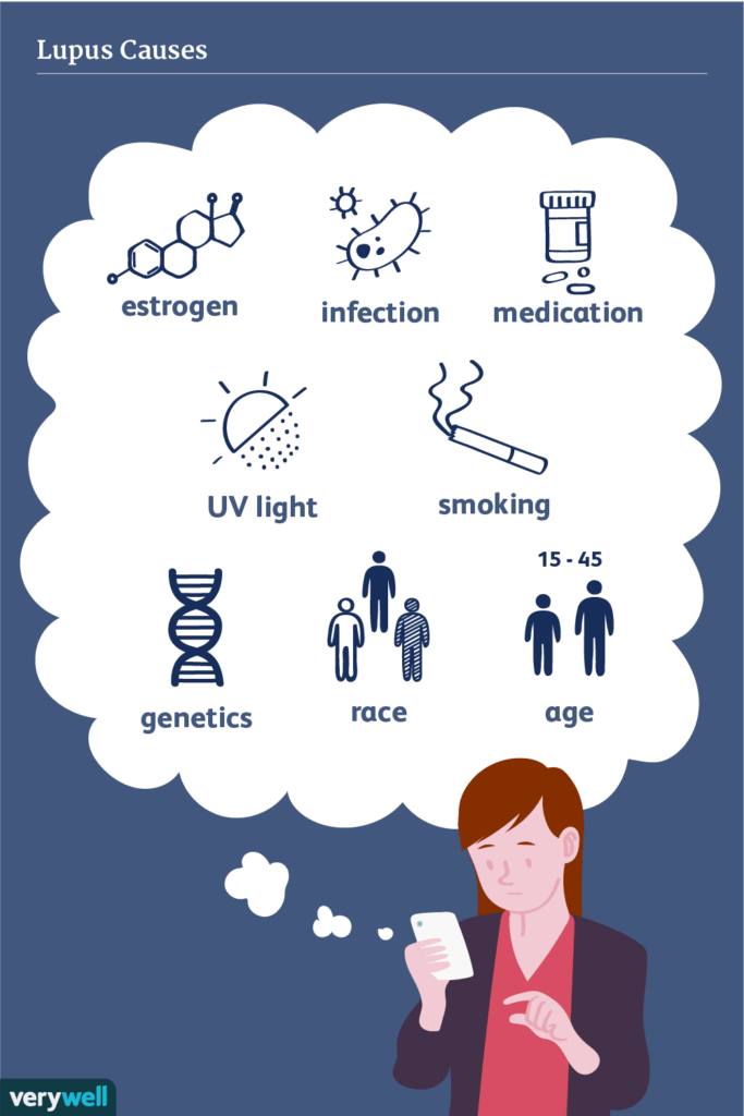 Risk Factors And Precautions For Lupus