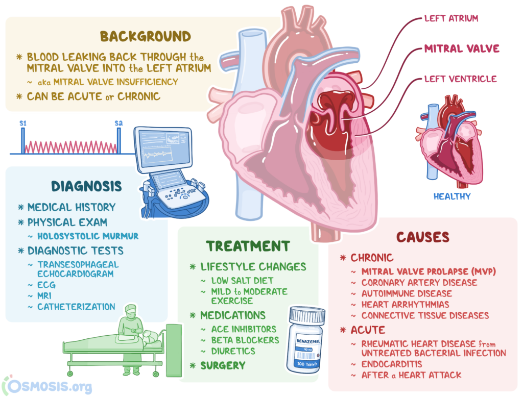 Risk Factors And Precautions For Mitral Valve Prolapse