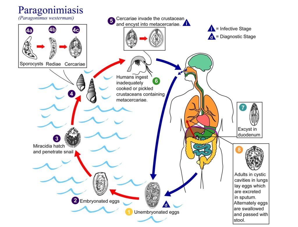 Risk Factors And Precautions For Paragonimiasis