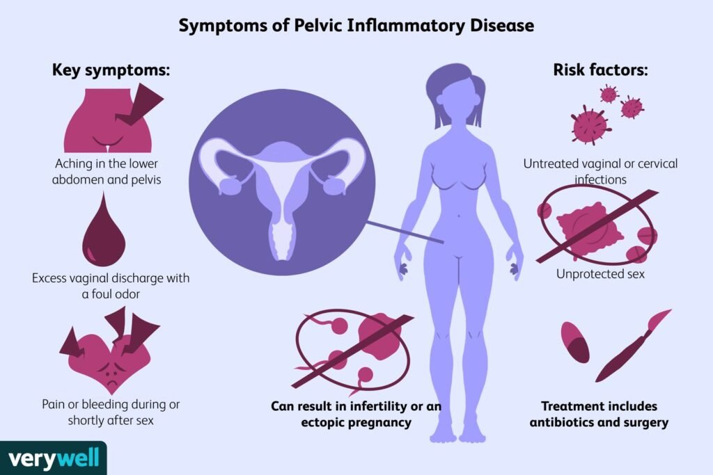 Risk Factors And Precautions For Pelvic Inflammatory Disease