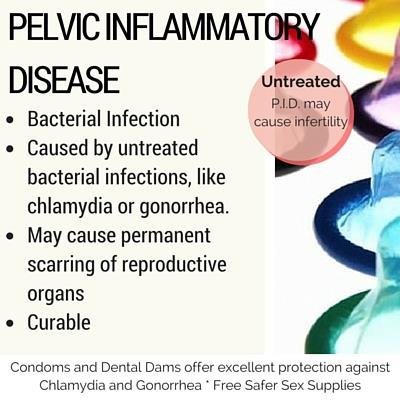 Risk Factors And Precautions For Pelvic Inflammatory Disease