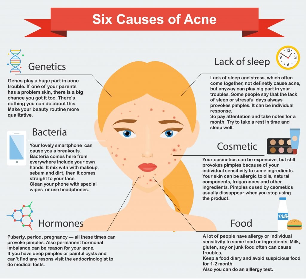 Risk Factors And Precautions For Pimples