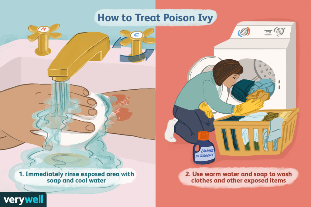 Risk Factors And Precautions For Poison Ivy