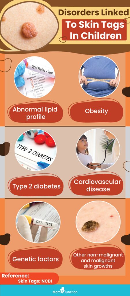 Risk Factors And Precautions For Skin Tags