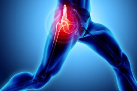 Risk Factors And Precautions For Snapping Hip Syndrome