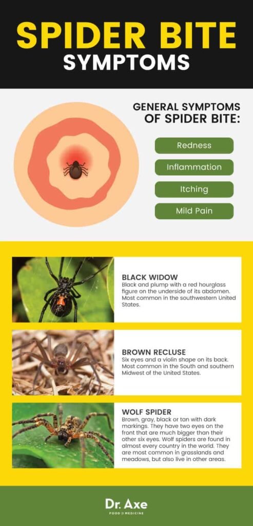 Risk Factors And Precautions For Spider Bites
