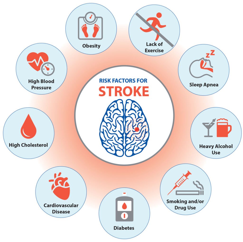 Risk Factors And Precautions For Stroke