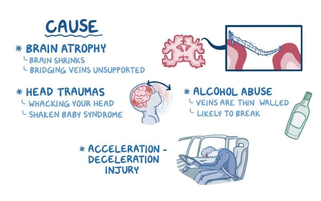 Risk Factors And Precautions For Subdural Hematoma