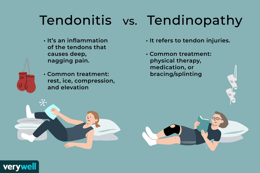 Risk Factors And Precautions For Tendinitis