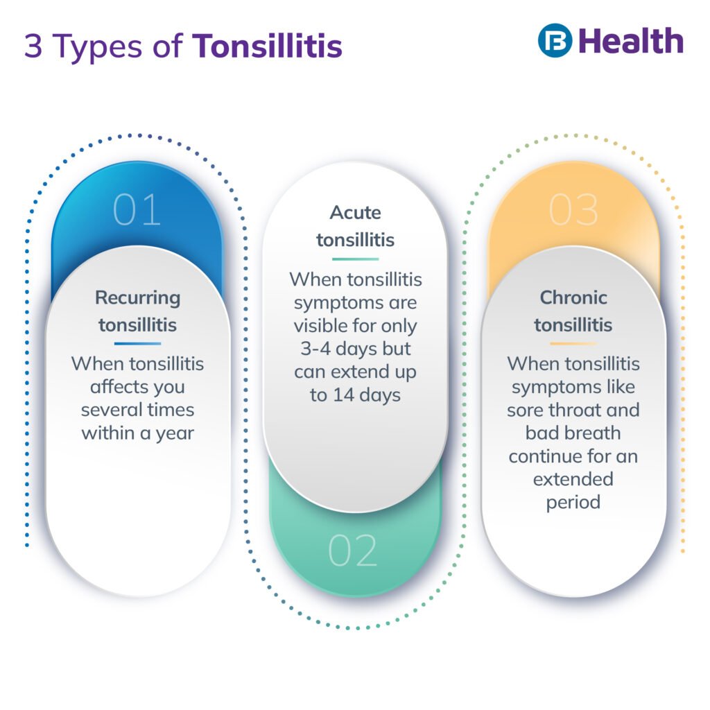 Risk Factors And Precautions For Tonsil Stones