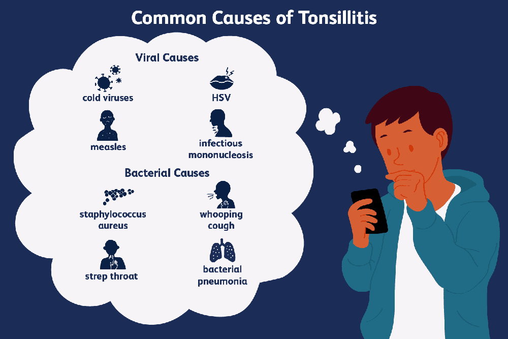 Risk Factors And Precautions For Tonsil Stones