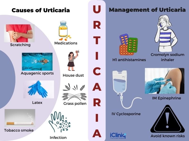 Risk Factors And Precautions For Urticaria
