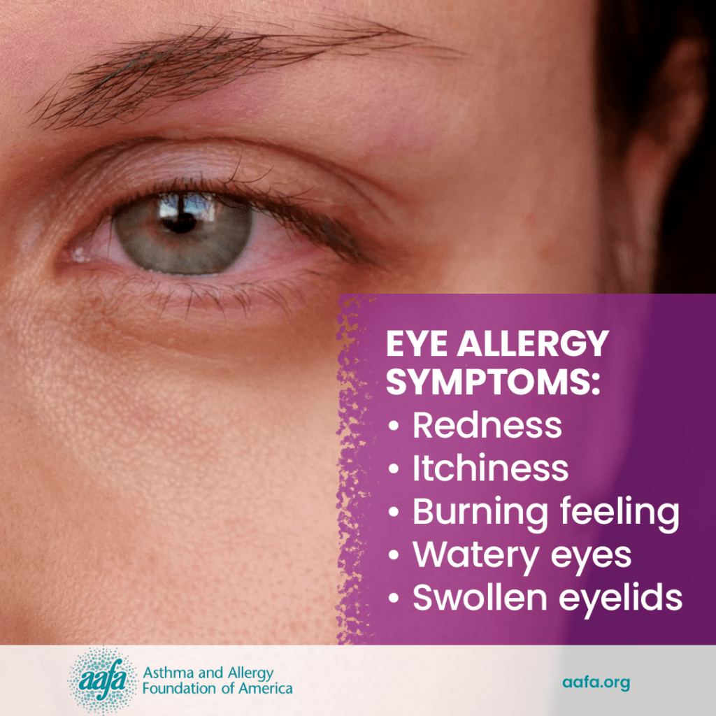 Seasonal Allergies and Conjunctivitis: Minimizing Discomfort and Finding Relief