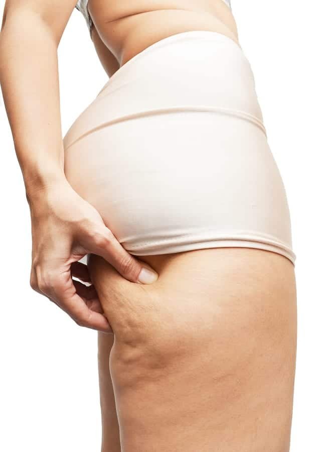 Secrets to Smoother Skin: Say Goodbye to Cellulite