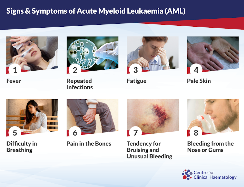 Signs and Symptoms of Acute Myeloid Leukemia in Children