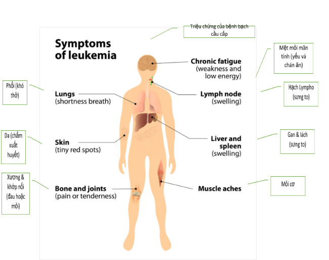 Signs and Symptoms of Acute Myeloid Leukemia in Children