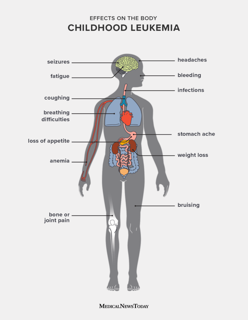 Signs and Symptoms of Acute Myeloid Leukemia in Children