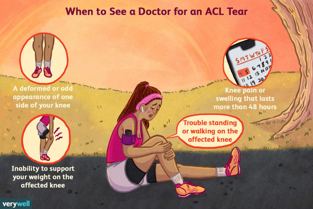 Signs and Symptoms of Anterior Cruciate Ligament (ACL) Injuries