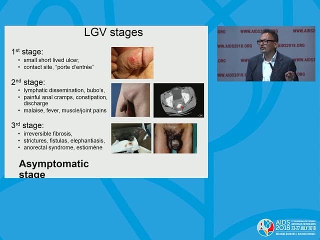 Signs and Symptoms of Lymphogranuloma Venereum (LGV)