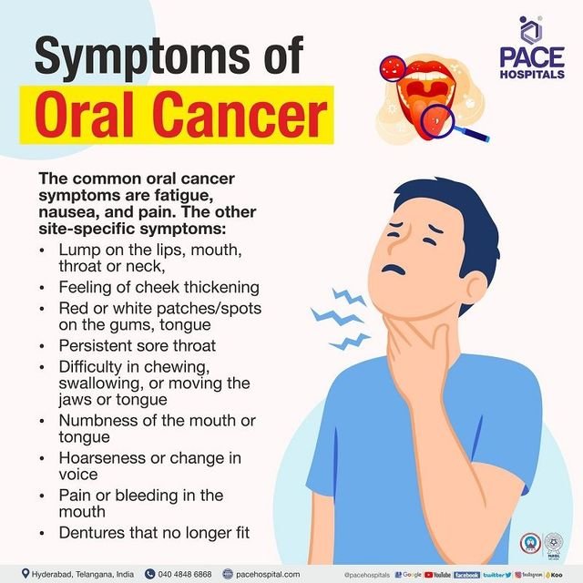 Signs and Symptoms of Mouth Cancer