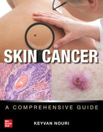Skin Cancer and Melanoma: A Comprehensive Guide