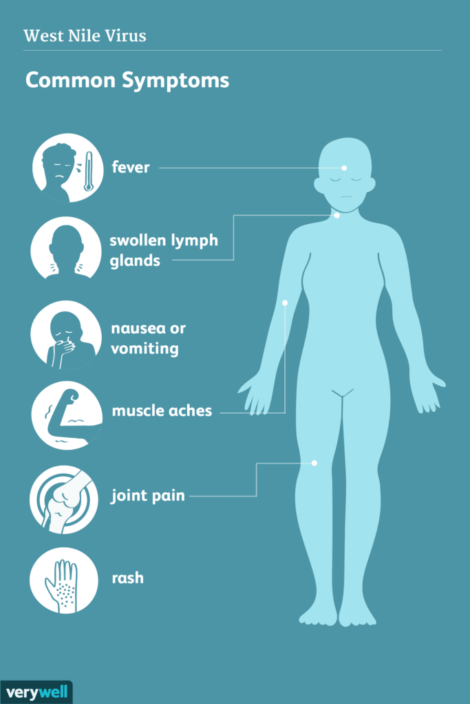 Symptoms and Treatment of West Nile Virus Infection