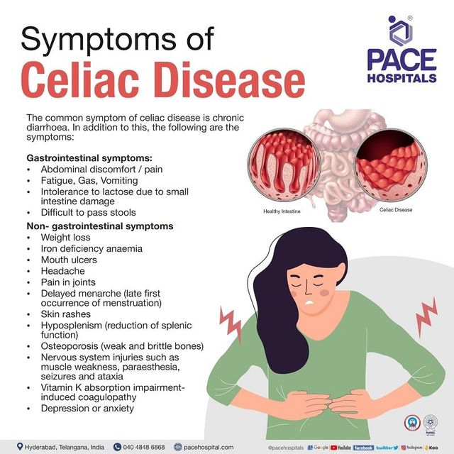 Symptoms of Celiac Disease Symptoms of Celiac Disease
