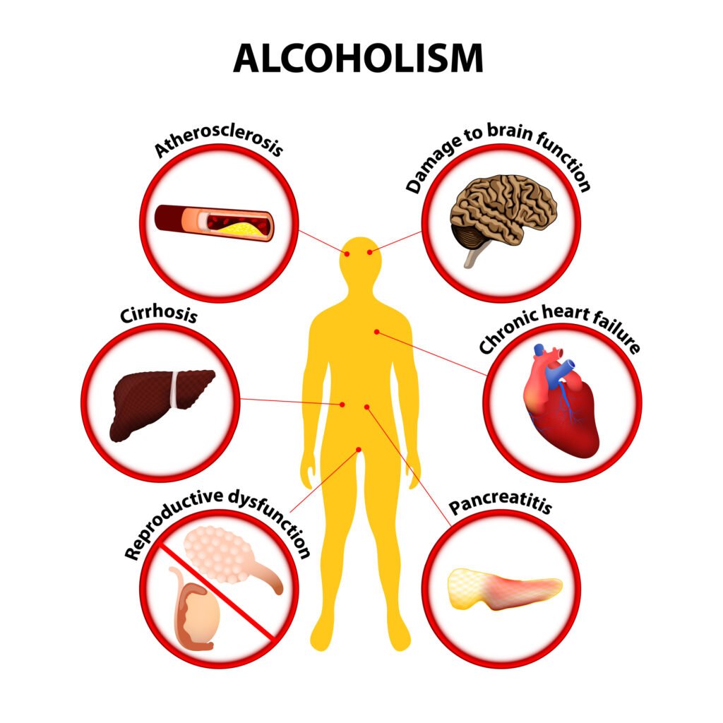 The Effects of Alcohol Abuse