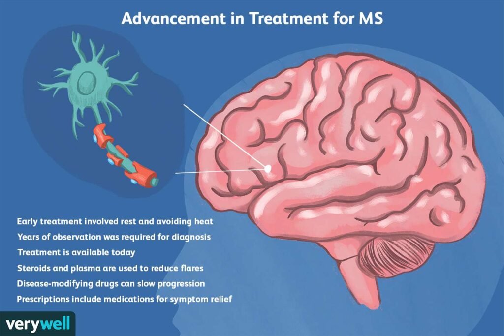 The Importance of Early Diagnosis in Multiple Sclerosis