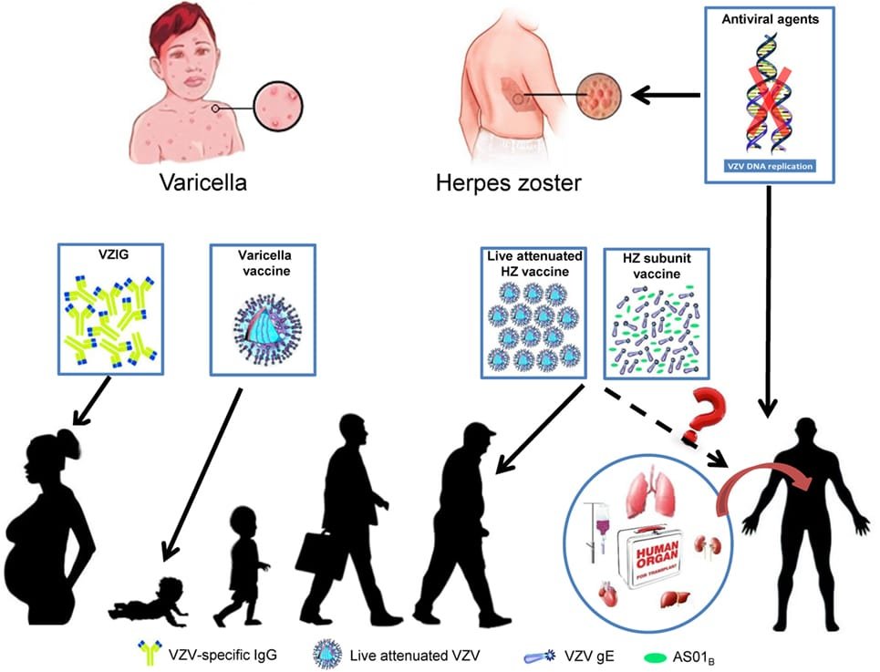 The Latest Research on Zoster-Herpes Virus and its Clinical Implications The Latest Research on Zoster-Herpes Virus and its Clinical Implications