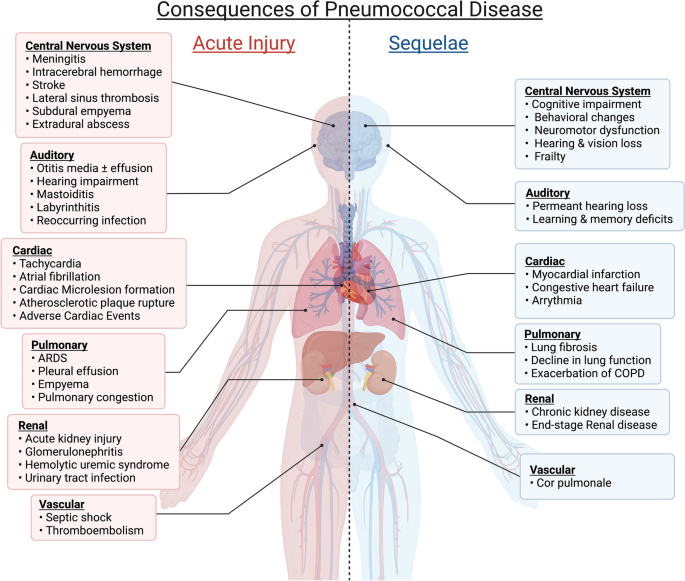 The Lethality of Invasive Pneumococcal Disease